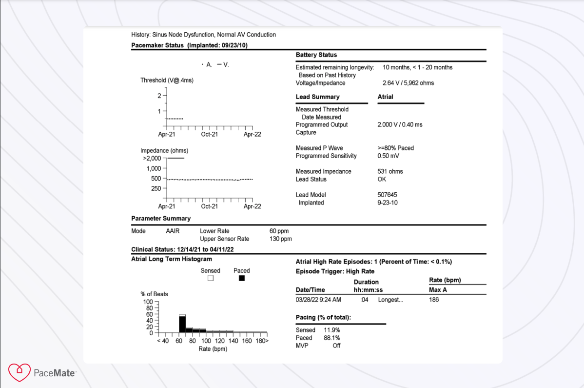 Case Report Impact of Replacement Time Pacing Behavior in